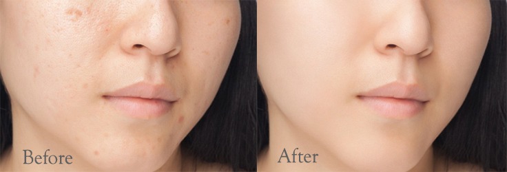 Professional photo retouching services